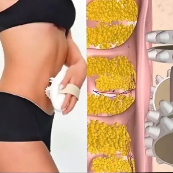 Масажер антицелюлітний Shuqin Body Slimmer SQ 100 sp859642 фото