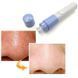Вакуумний очищувач пор Pore Cleaner 226204 фото 2