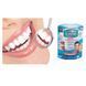 Знімні вініри Perfect Smile Veneers, вініри для зубів, накладні зуби, накладки для зубів 2260038 фото 3