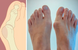Магнітна вальгусна шина RELAX FOOT (Magnet Fix) Магнітний коректор стопи GK0657 фото 6