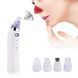 Вакуумний очисник Derma suction DS Vacuum для професійної чистки шкіри та пор обличчя - легкий компактний зручний прилад у використанні + 4 насадки, Білий 205021 фото 2