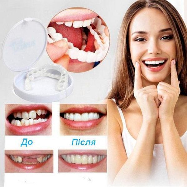 Вініри для зубів верх Snap On Smile Jam3014 фото