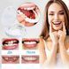 Вініри для зубів верх Snap On Smile Jam3014 фото 2